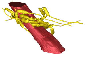 3D reconstruction of an ant mandible adductor muscle (red) surrounded by a network of fungal cells (yellow). (Image: Hughes Laboratory/Penn State)